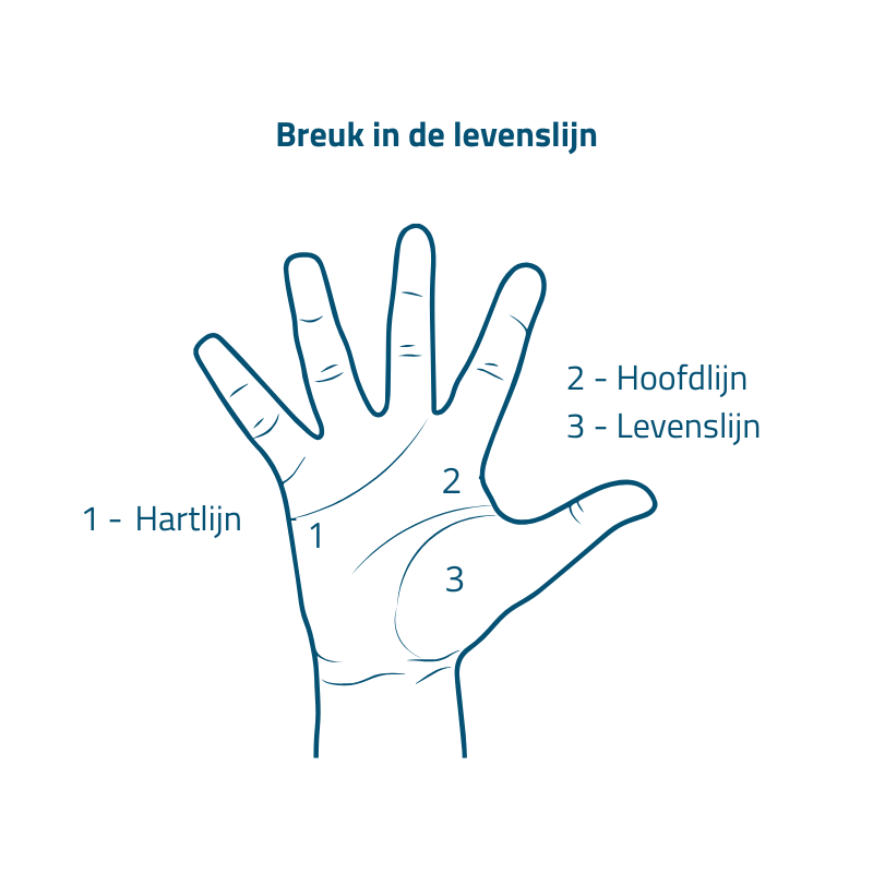 gebroken levenslijn